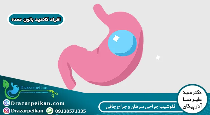 چه کسانی می توانند از بالون معده استفاده کنند؟