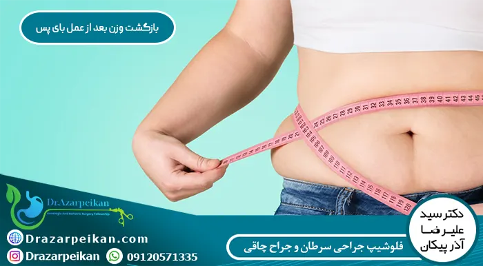بازگشت وزن بعد از عمل بای پس