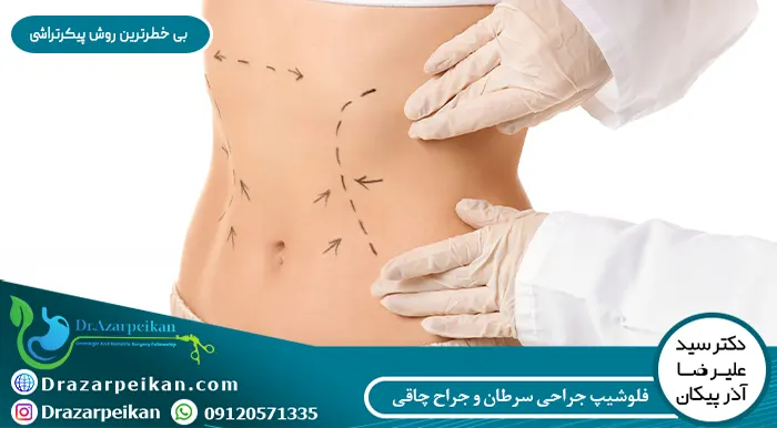 بی خطرترین روش پیکرتراشی که در آن احتمال خطر مرگ بر اثر ابدومینوپلاستی و مرگ در اثر لیپوماتیک وجود ندارد
