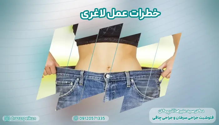 خطرات و عوارض عمل لاغری: 12 عوارض جراحی لاغری کوتاه مدت و بلندمدت