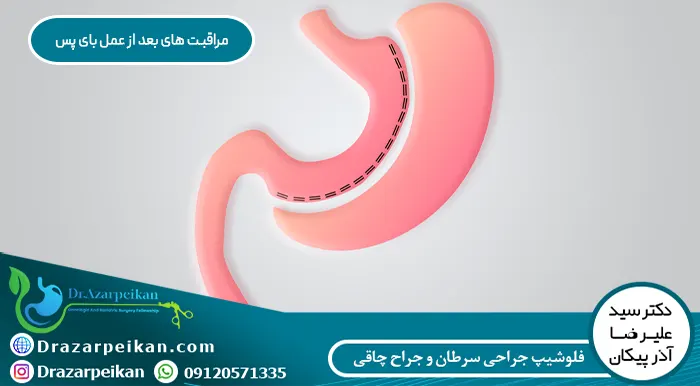 مراقبت های بعد از عمل بای پس