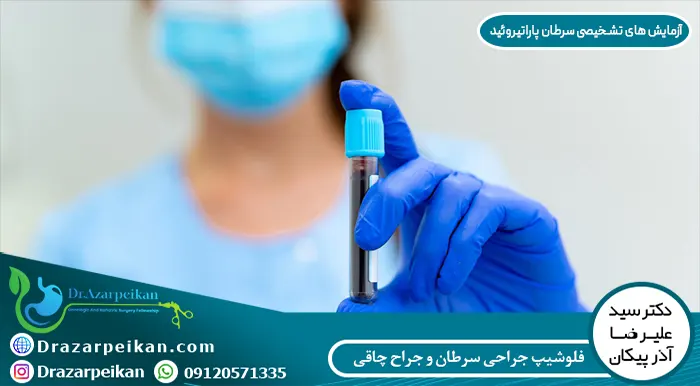 آزمایش های تشخیصی سرطان پاراتیروئید آزمایش های تشخیصی سرطان پاراتیروئید