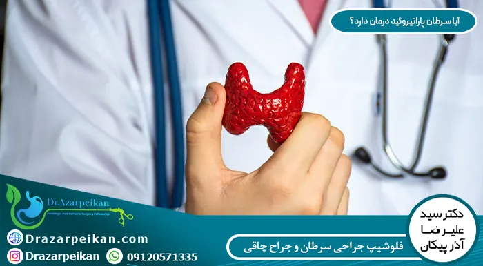 درمان سرطان پاراتیروئید درمان سرطان پاراتیروئید