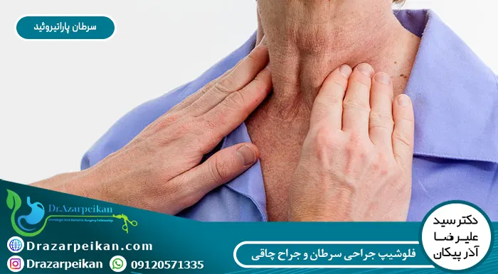 سرطان پاراتیروئید سرطان پاراتیروئید چیست