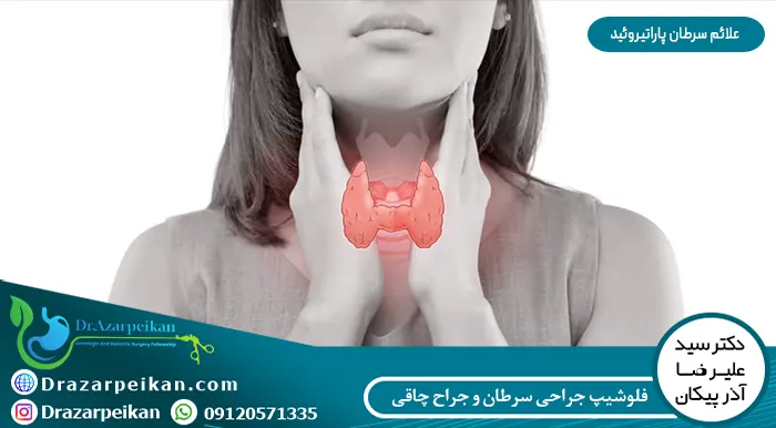 علائم سرطان پاراتیروئید علائم سرطان پاراتیروئید