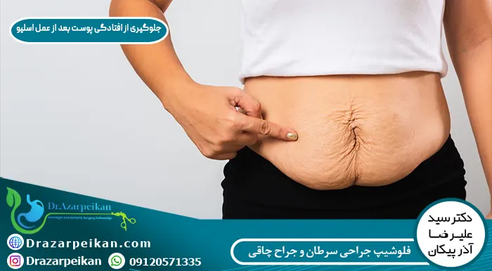 جلوگیری از افتادگی پوست بعد از عمل اسلیو علت شل شدن پوست چیست؟