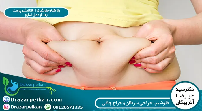 جلوگیری از فتادگی پوست جلوگیری از فتادگی پوست