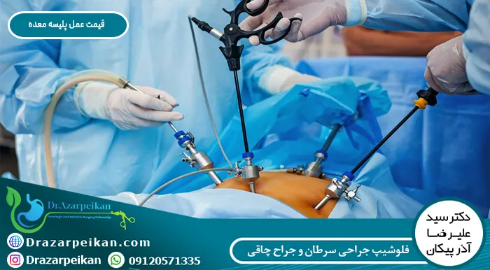 هزینه عمل پلیسه معده قیمت عمل پلیسه معده چقدر است؟