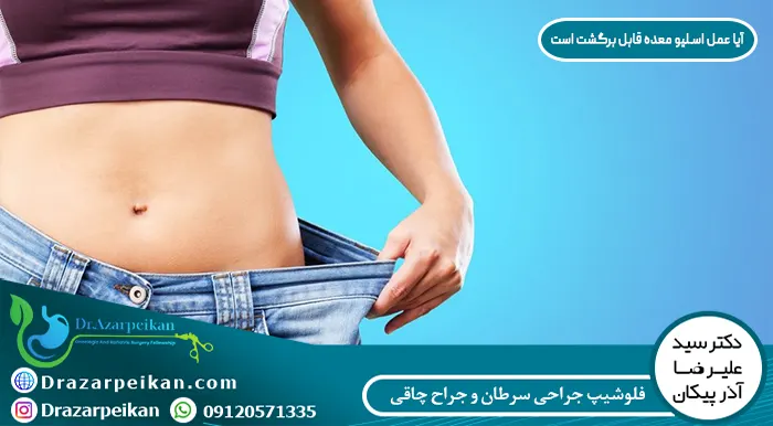 آیا عمل اسلیو معده قابل برگشت است آیا عمل اسلیو معده قابل برگشت است