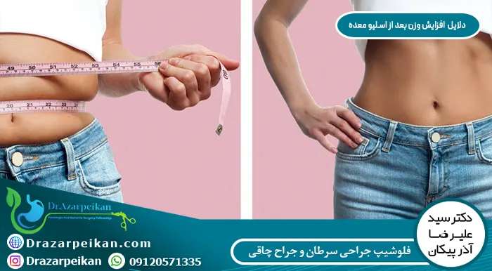 باعث افزایش وزن بعد از اسلیو معده