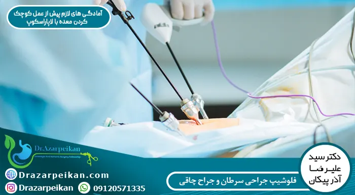 آمادگی های لازم پیش از عمل کوچک کردن معده با لاپاراسکوپ
