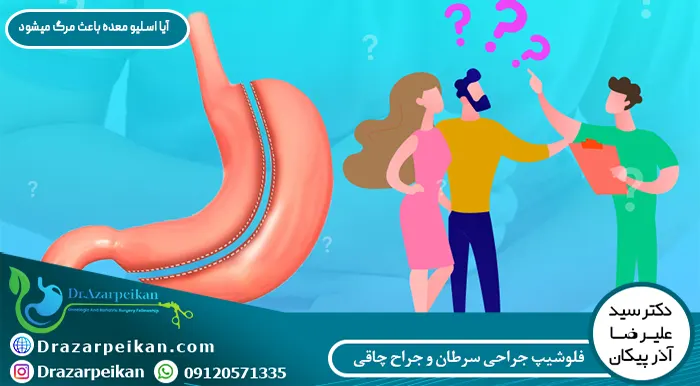 آیا اسلیو معده باعث مرگ میشود
