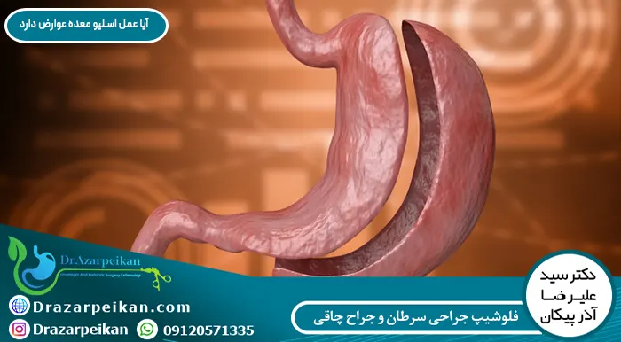 آیا عمل اسلیو معده عوارض دارد