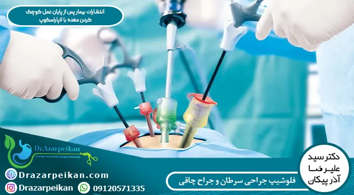 انتظارات بیمار پس از پایان عمل کوچک کردن معده با لاپاراسکوپ