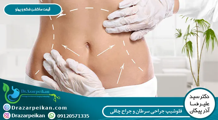 قیمت ساکشن شکم و پهلو در کلینیک دکتر آذرپیکان