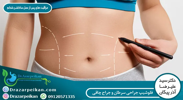 مراقبت های پس از عمل لیپوساکشن کدام اند؟