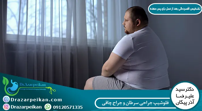 تشخیص افسردگی بعد از عمل بای پس معده