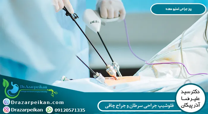 نقاهت روز جراحی اسلیو معده