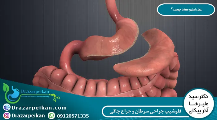 عمل اسلیو معده چیست؟