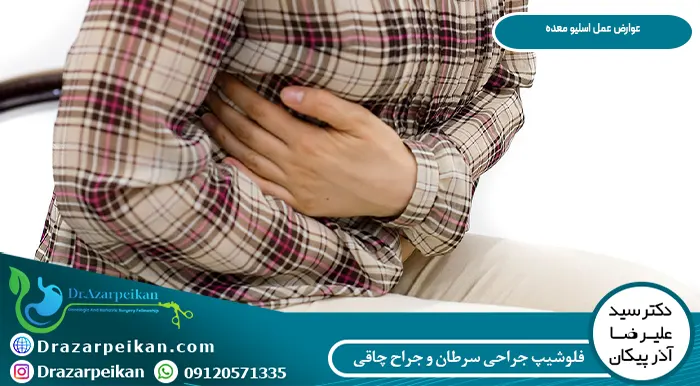 درد بعد عمل اسلیو معده