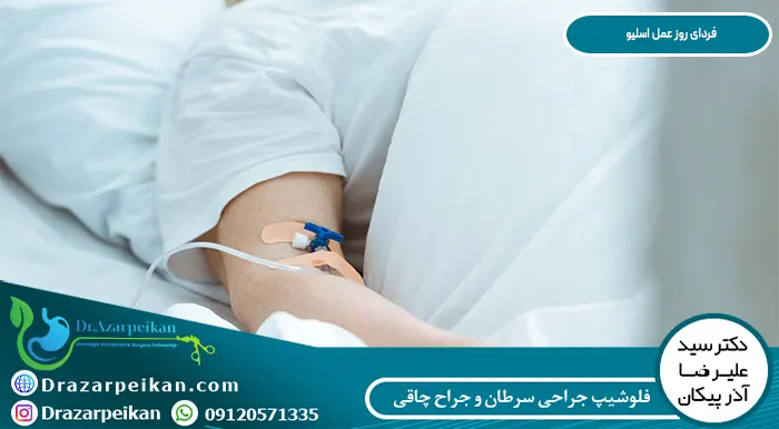 دوره نقاهت فردای روز عمل اسلیو