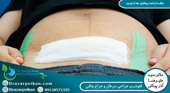 مراقبت از زخم در ریکاوری