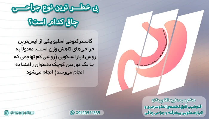 بی خطر ترین عمل جراحی چاقی