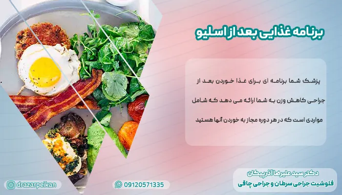 برنامه غذایی بعد از عمل اسلیو معده