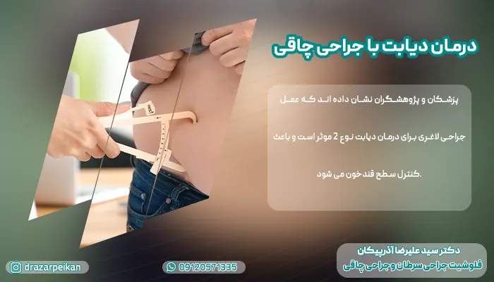 دیابت با جراحی چاقی درمان دیابت نوع 2 با جراحی چاقی