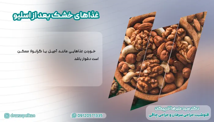 غذاهای خشک بعد از اسلیو معده غذاهای خشک بعد از اسلیو معده