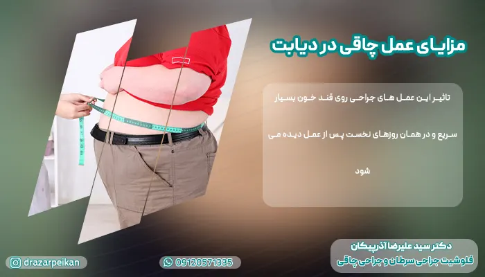 درمان دیابت با جراحی چاقی درمان دیابت با جراحی چاقی