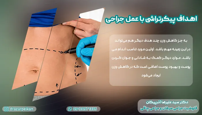 پیکرتراشی با عمل جراحی پیکرتراشی با عمل جراحی
