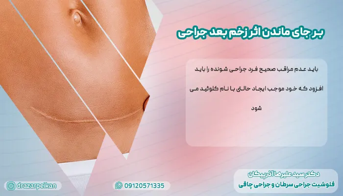 بر جای ماندن اثر زخم بعد جراحی بر جای ماندن اثر زخم بعد جراحی