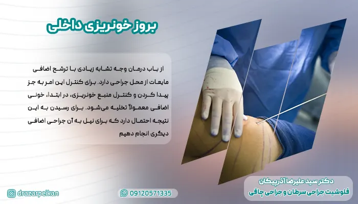 بروز خونریزی داخلی بروز خونریزی داخلی