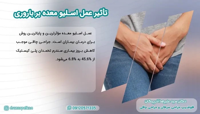تأثیر عمل اسلیو معده بر باروری تأثیر عمل اسلیو معده بر باروری
