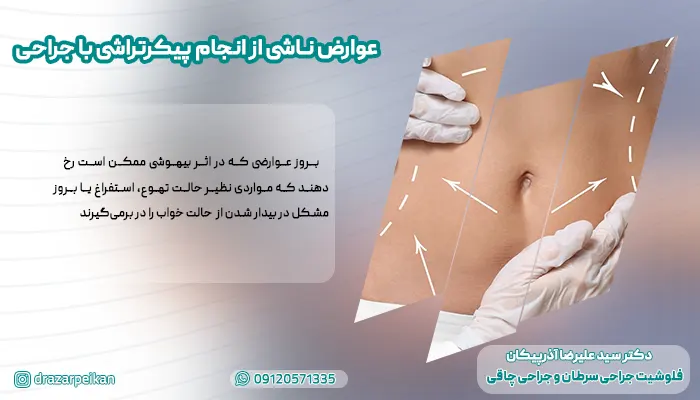 عوارض پیکرتراشی با عمل جراحی عوارض پیکرتراشی با عمل جراحی