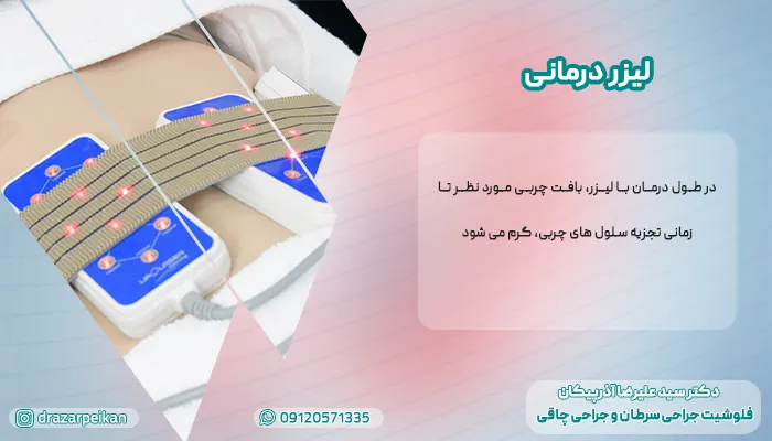 عمل پیکرتراشی بدون جراحی عمل پیکرتراشی بدون جراحی