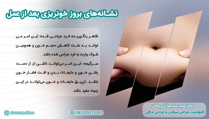 نشانه های بروز خونریزی بعد از عمل نشانه های بروز خونریزی بعد از عمل