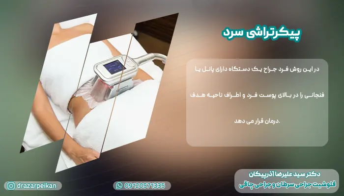 پیکرتراشی سرد روش پیکرتراشی سرد