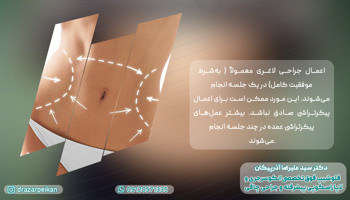 عمل پیکرتراشی تعداد جلسات درمانی