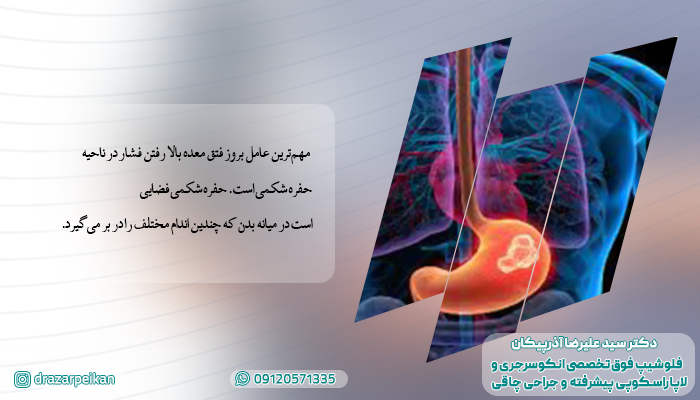 علت فتق معده دلایل بروز فتق معده چیست؟