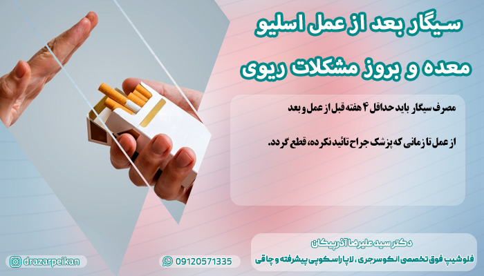 سیگار بعد از عمل اسلیو معده سیگار بعد از عمل اسلیو معده