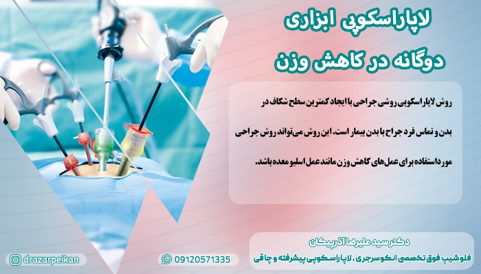 لاپاراسکوپی ابزاری دوگانه در کاهش وزن لاپاراسکوپی ابزاری دوگانه در کاهش وزن