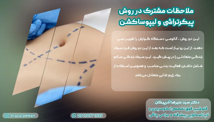 مراقبت های پیکرتراشی
