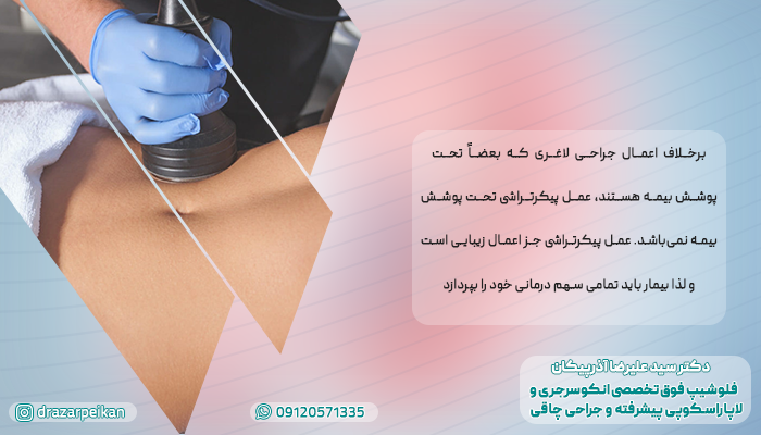 پیکرتراشی کل بدن در تهران پوشش بیمه درمانی