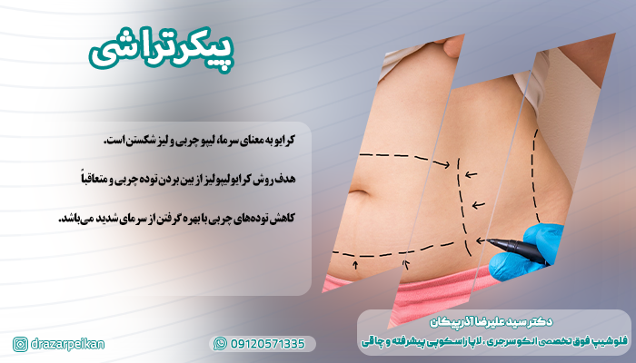 روش های پیکرتراشی پیکرتراشی را به عنوان یکی از سریع ترین روش های عمل لاغری می توان معرفی کرد.
