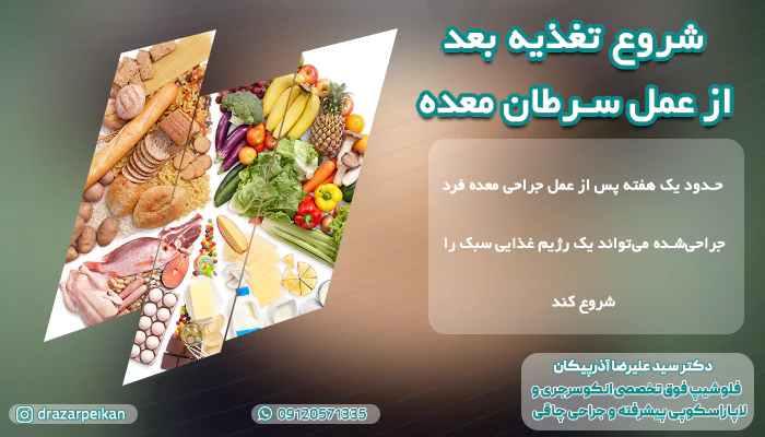 شروع تغذیه بعد از عمل سرطان معده