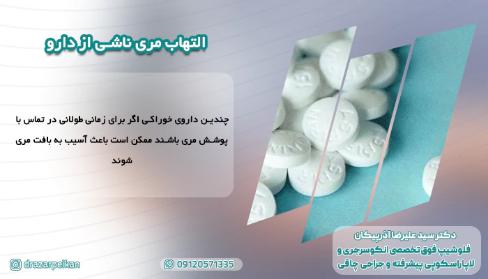 التهاب مری ناشی از دارو التهاب مری ناشی از دارو معمولا در طولانی مدت اتفاق می افتد.