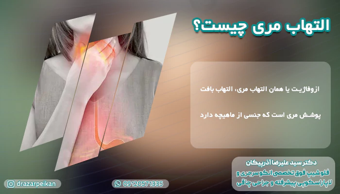 علت التهاب مری و راه درمان آن علت زخم مری + درمان التهاب مری | منشا درد مری کجاست؟