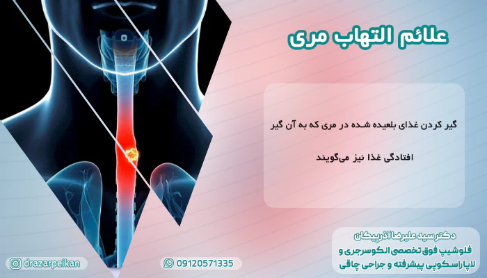 علائم التهاب مری علائم ایجاد التهاب مری و عوارض آن به چه صورت است؟